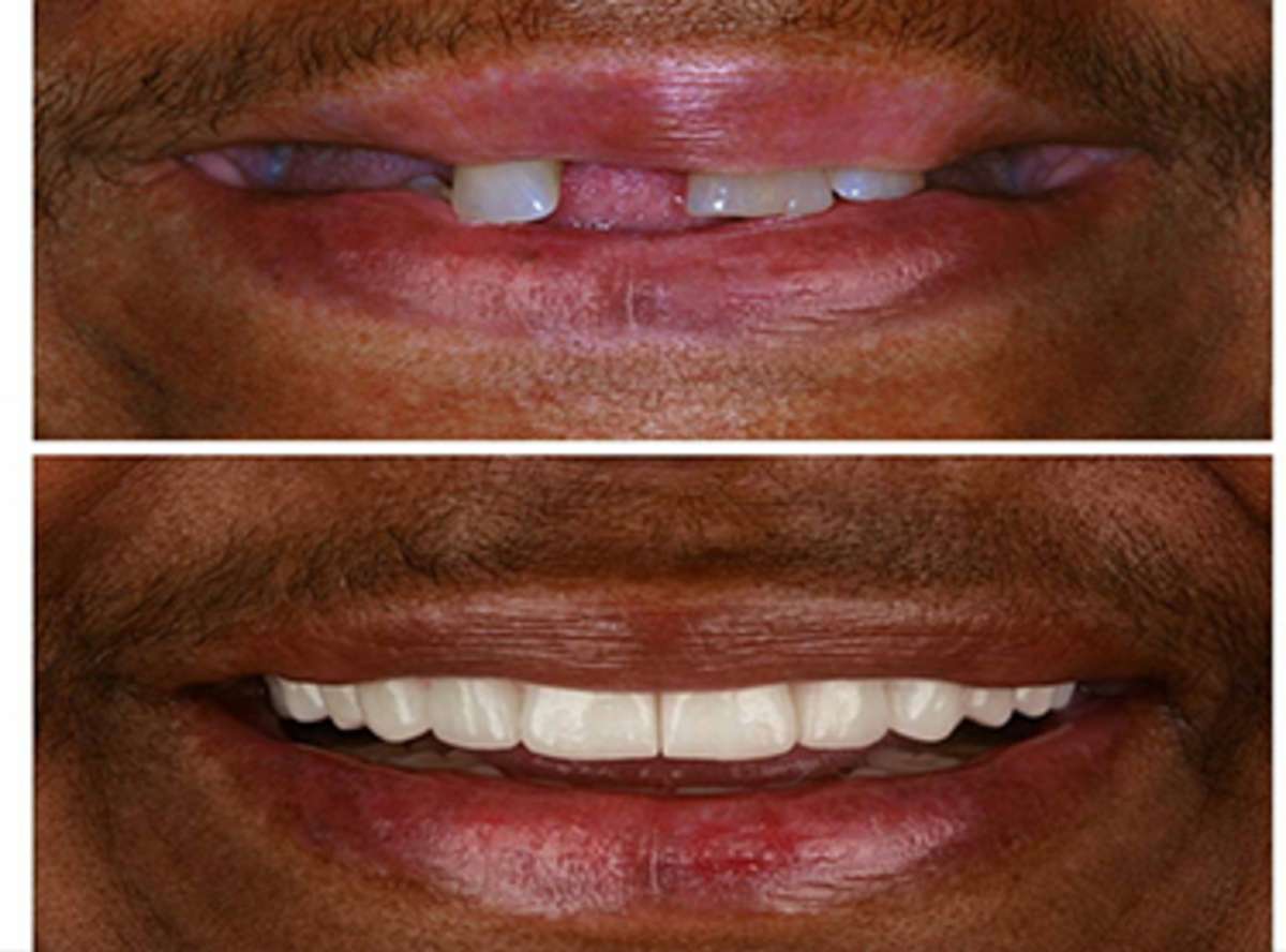 Unattractive Smile treatment near me