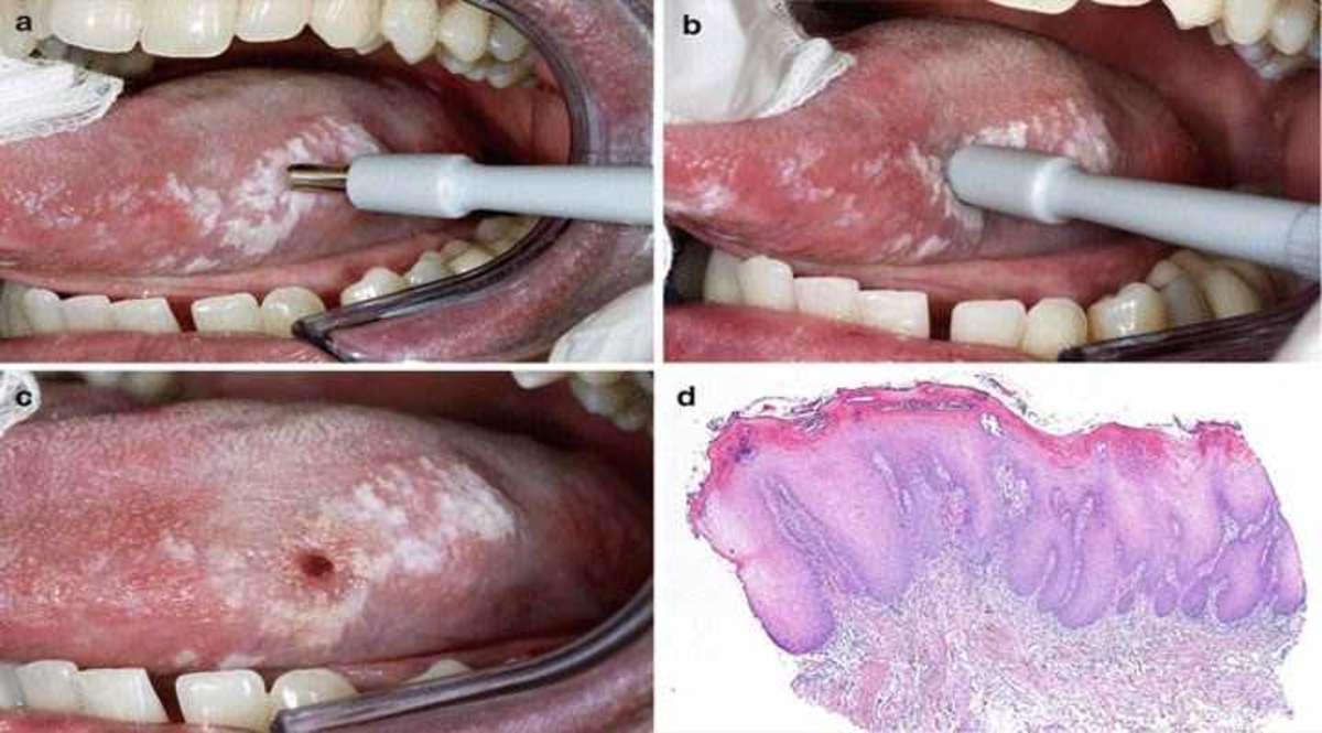 Dental Implant