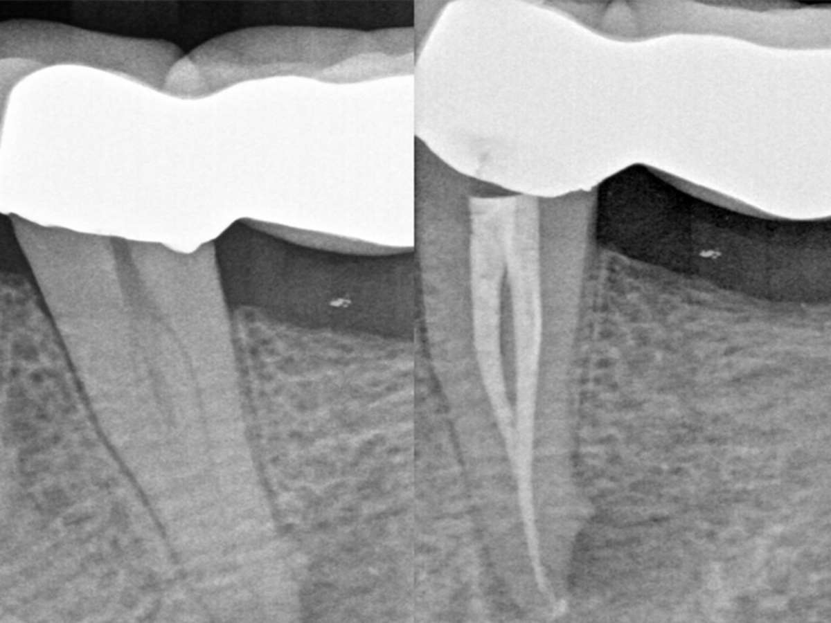 Procedure