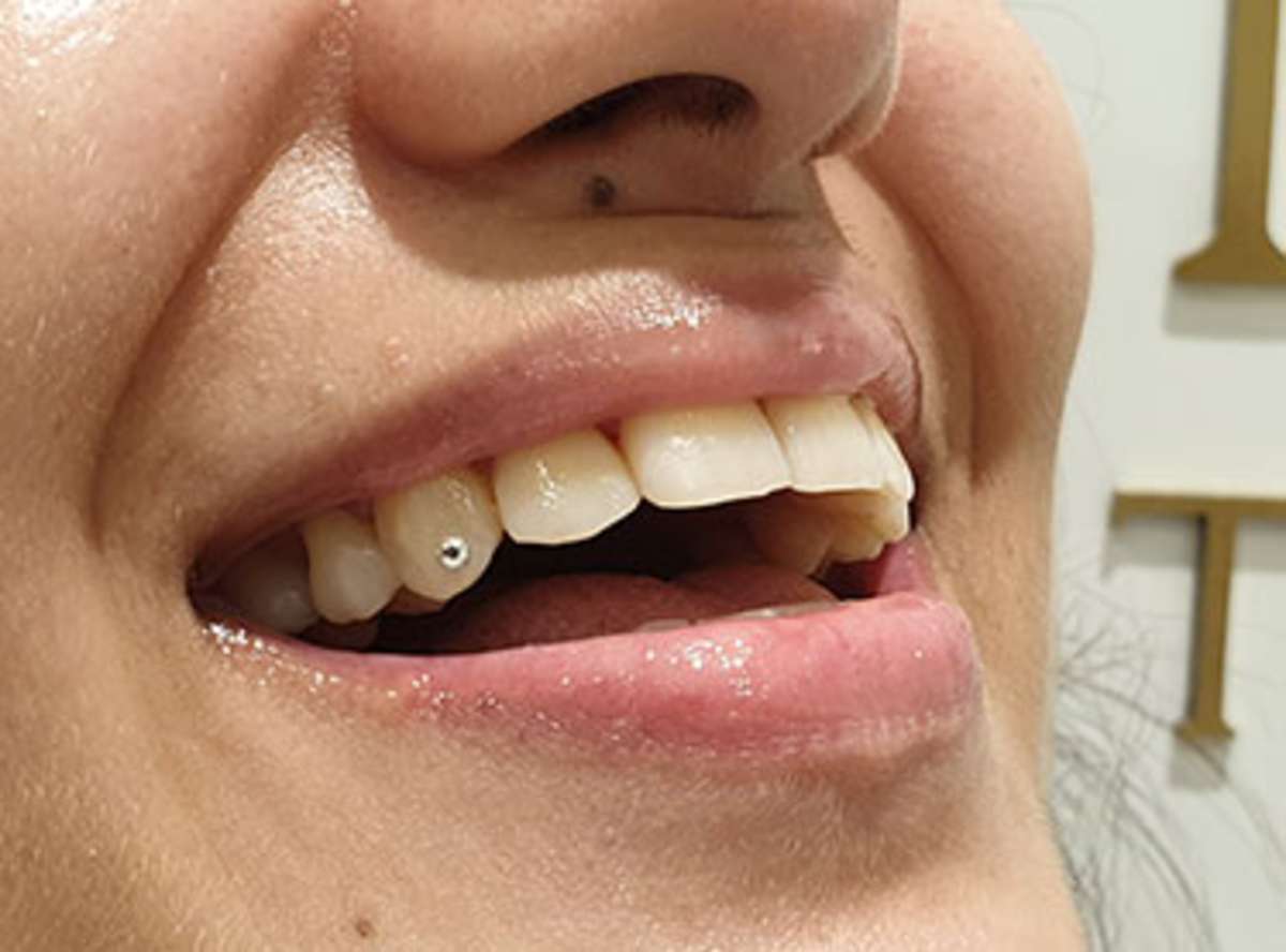 Tooth Jewellery dentist near me