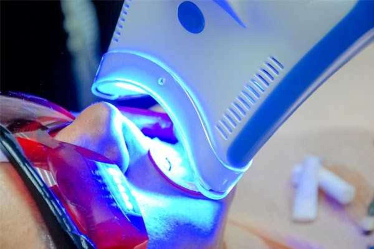 Philips zoom teeth whitening near me