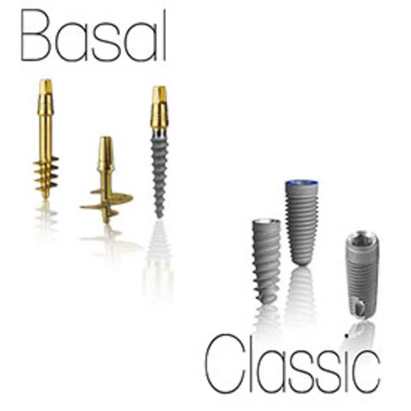 cost of Basal Implants in India