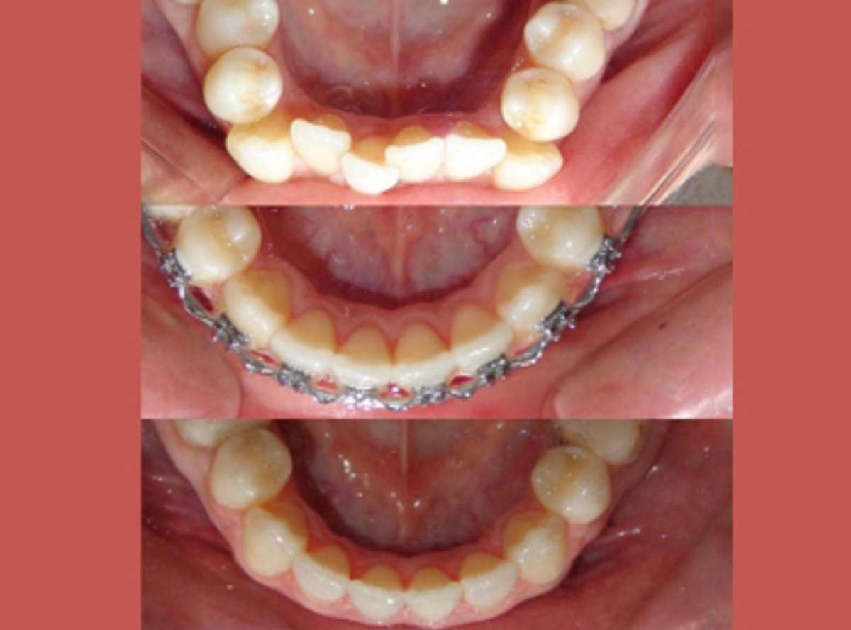 Orthodontic Treatments in Delhi